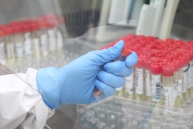 上（shàng）海石化全力生產核酸（suān）采（cǎi）樣管聚乙烯產品